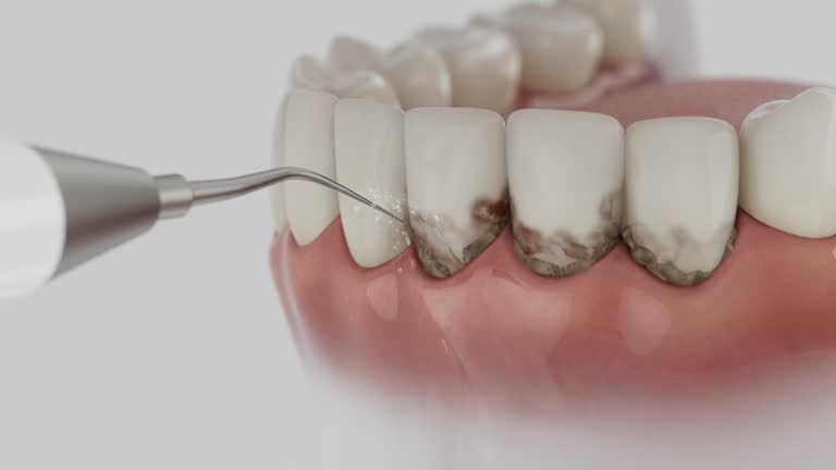 Reliable Dental contractor in Shackle Island, TN by Dentist Open Now